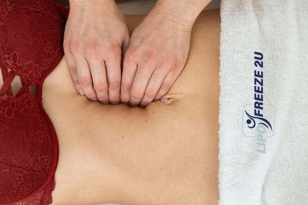 diastasis recti treatment Wincanton