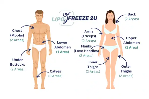 Areas you can have fat freezing treatment Wincanton