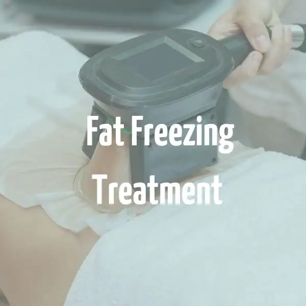 fat freezing treatment Wincanton