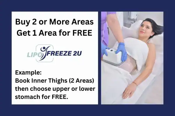 fat freezing prices Wincanton