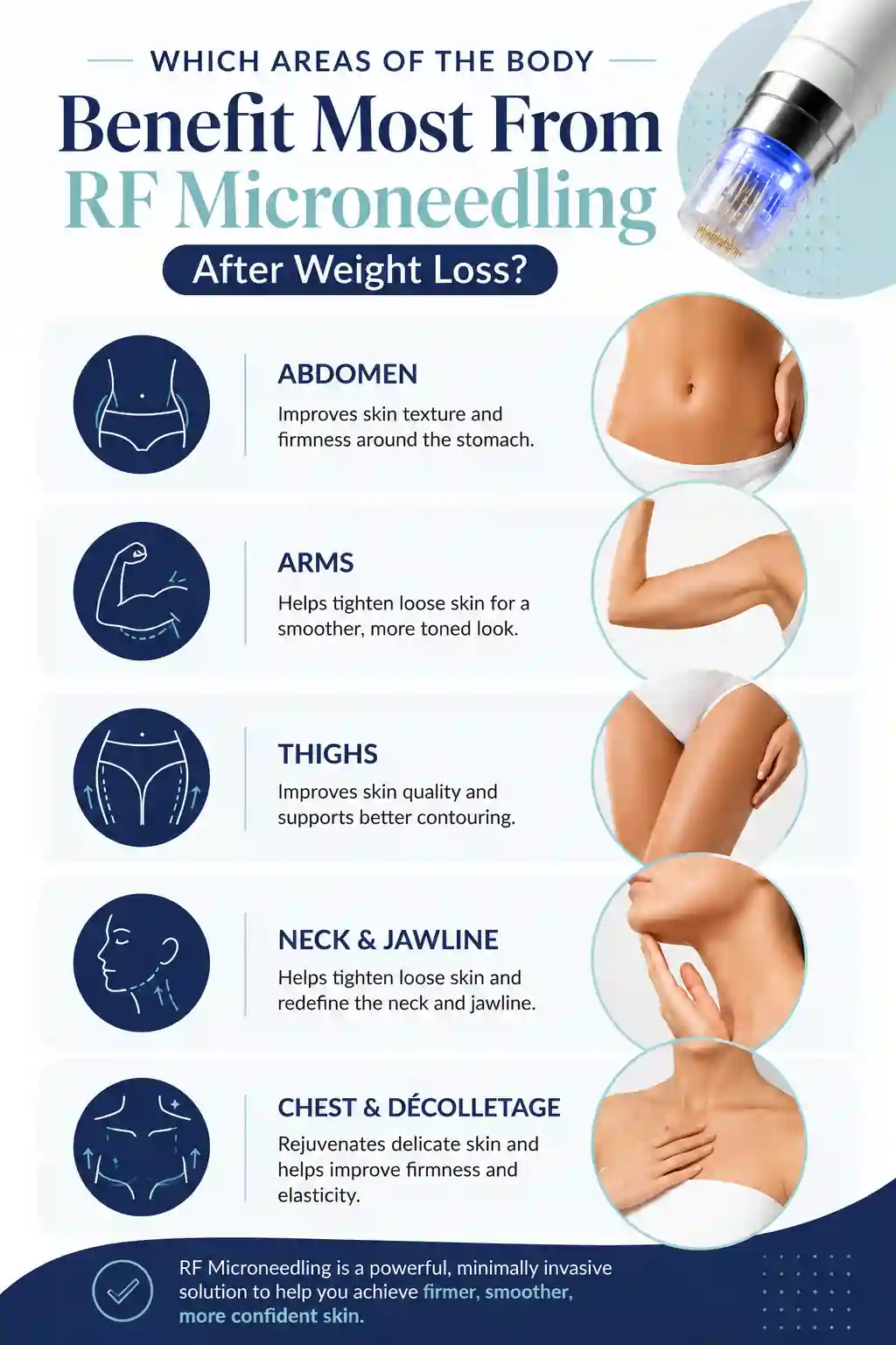 Which Areas of the Body Benefit Most From RF Microneedling After Weight Loss Wincanton